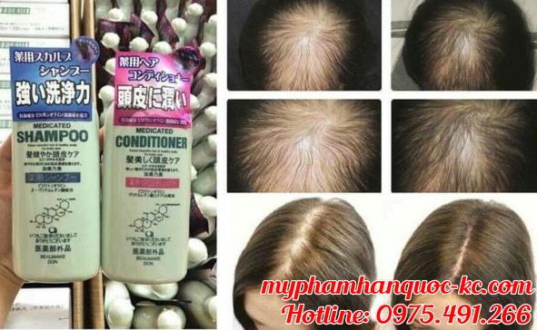 Dau-goi-kich-thich-moc-toc-Kaminomoto-Medicated-Shampoo-Nhat-Ban_result